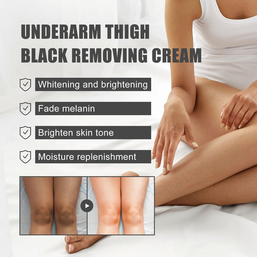 Anti-Darkening Cream Whitening Cream For Underarms And Thighs