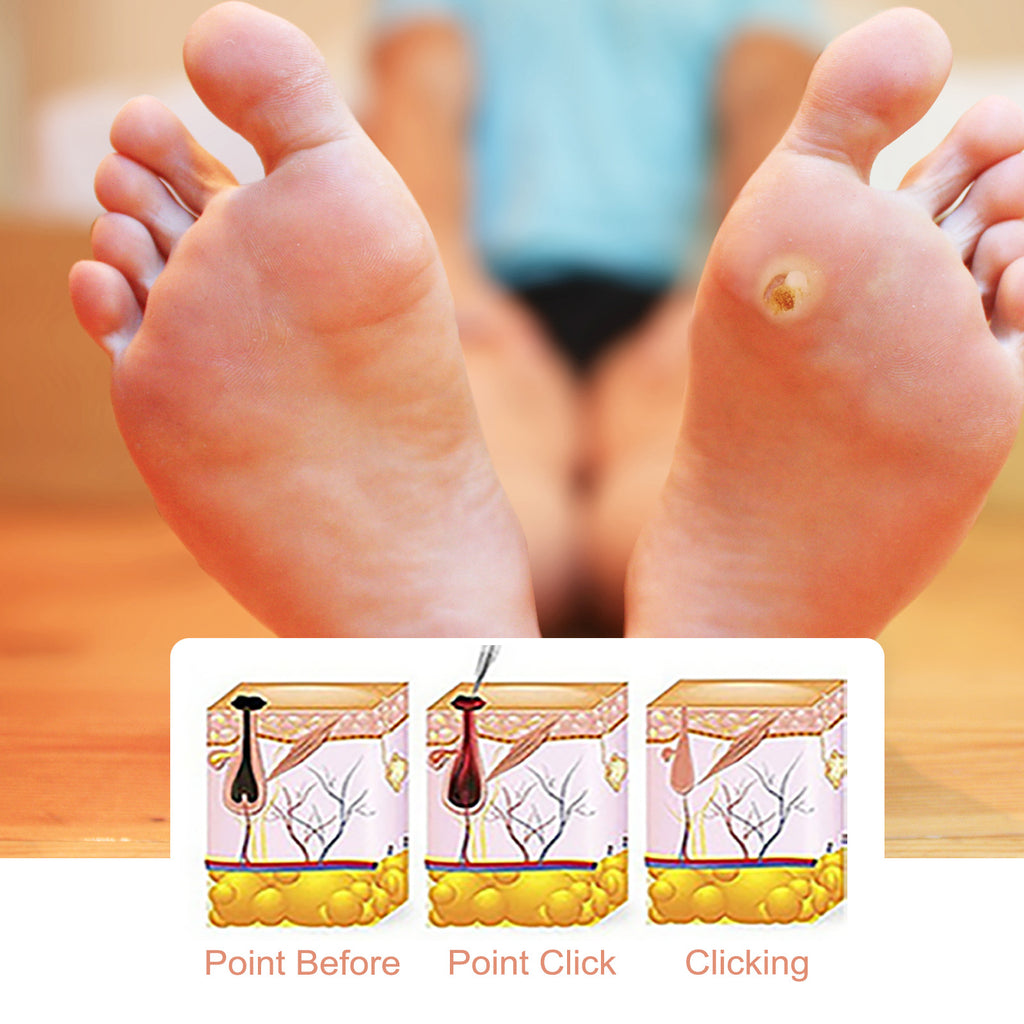 SOUTH MOON Foot Care Solution - Cleanses And Moisturizes Body