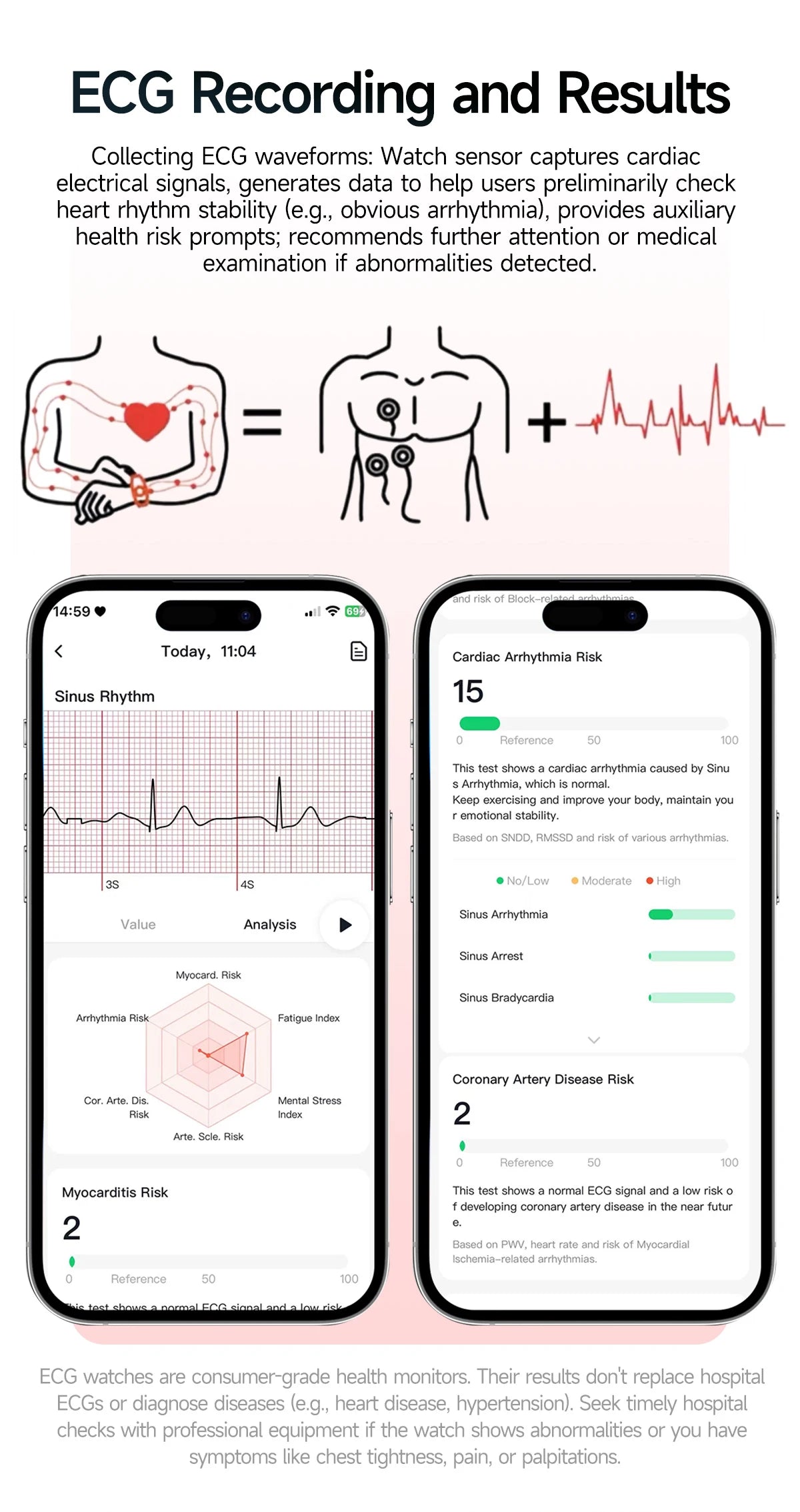 New Professional Health Watch Blood Pressure 2.01"AMOLED Screen Uric Acid Blood Lipids Flashlight Care Smart Watches for Women