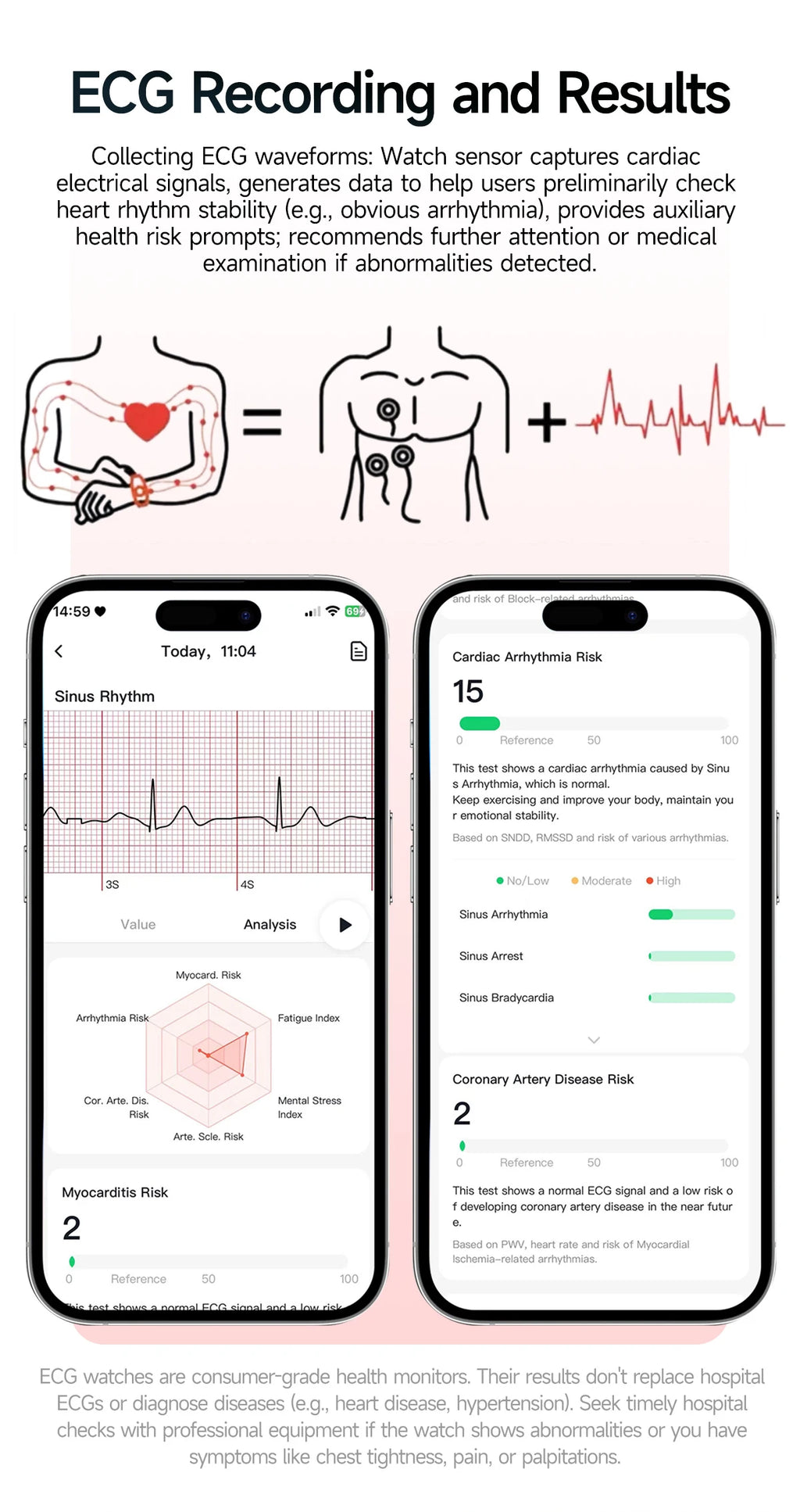 New Professional Health Watch Blood Pressure 2.01"AMOLED Screen Uric Acid Blood Lipids Flashlight Care Smart Watches for Women