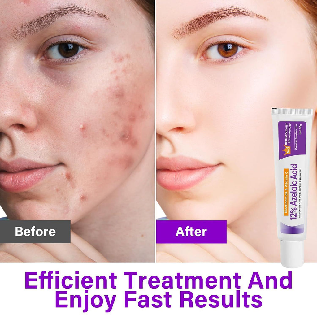 Azelaic Acid Serum, Niacinamide Ointment, Soothing Skin Gel For